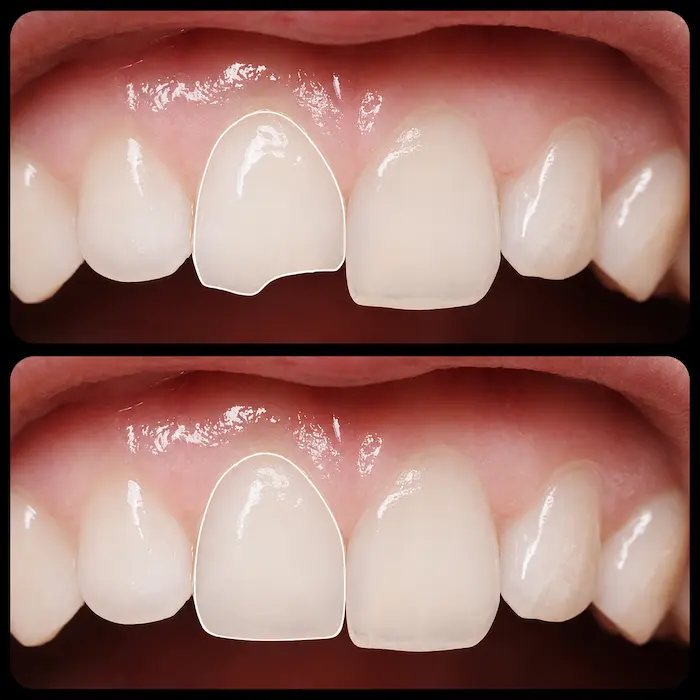 Atendimento odontológico de urgência Dentalli