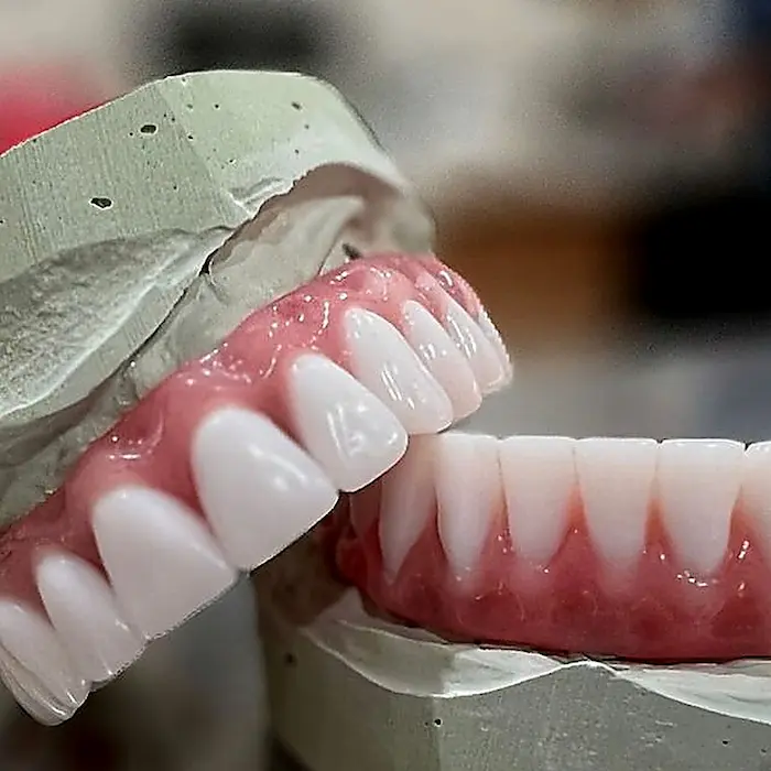 Prótese dentária